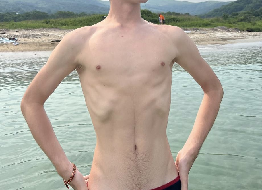Mark — before